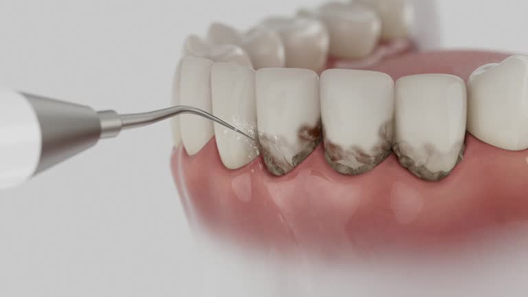 Trusted Wisdom Tooth Removal service in Valley, AL - Dentist Open Now